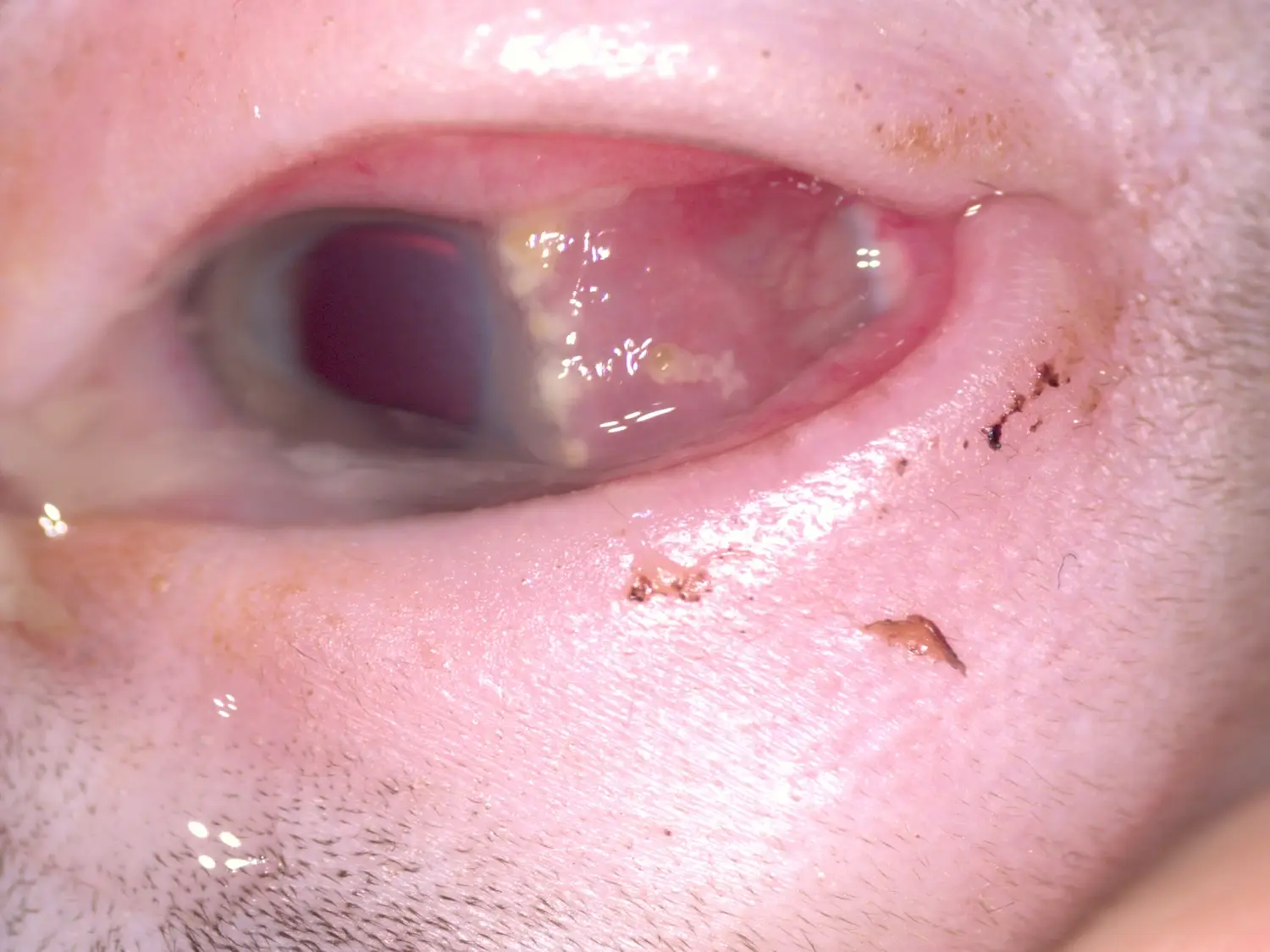 Oko s příznaky eosinofilní keratitidy | Veterinární klinika Medipet Zlín