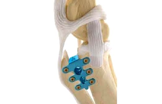 Medipet Zlín - TTA Rapid