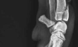 Pacient č.: 1. - rtg před operací  | Veterinární klinika Medipet Zlín