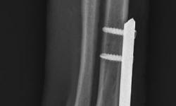 Pacient č.: 1. - rtg po operaci  | Veterinární klinika Medipet Zlín