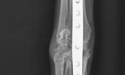 Pacient č. 3. - pooperační rtg | Veterinární klinika Medipet Zlín