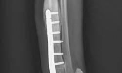 Pacient č. 3. - pooperační rtg 2. | Veterinární klinika Medipet Zlín