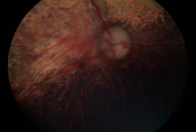 CEA | Veterinární klinika Medipet Zlín