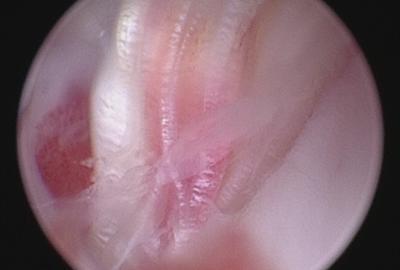 Artroskopické vyšetření - přetržení předního zkříženého vazu | Veterinární klinika Medipet Zlín