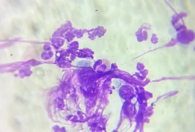 Cytlogický preparát ze stěru - přítomnost eosinofilů | Veterinární klinika Medipet Zlín